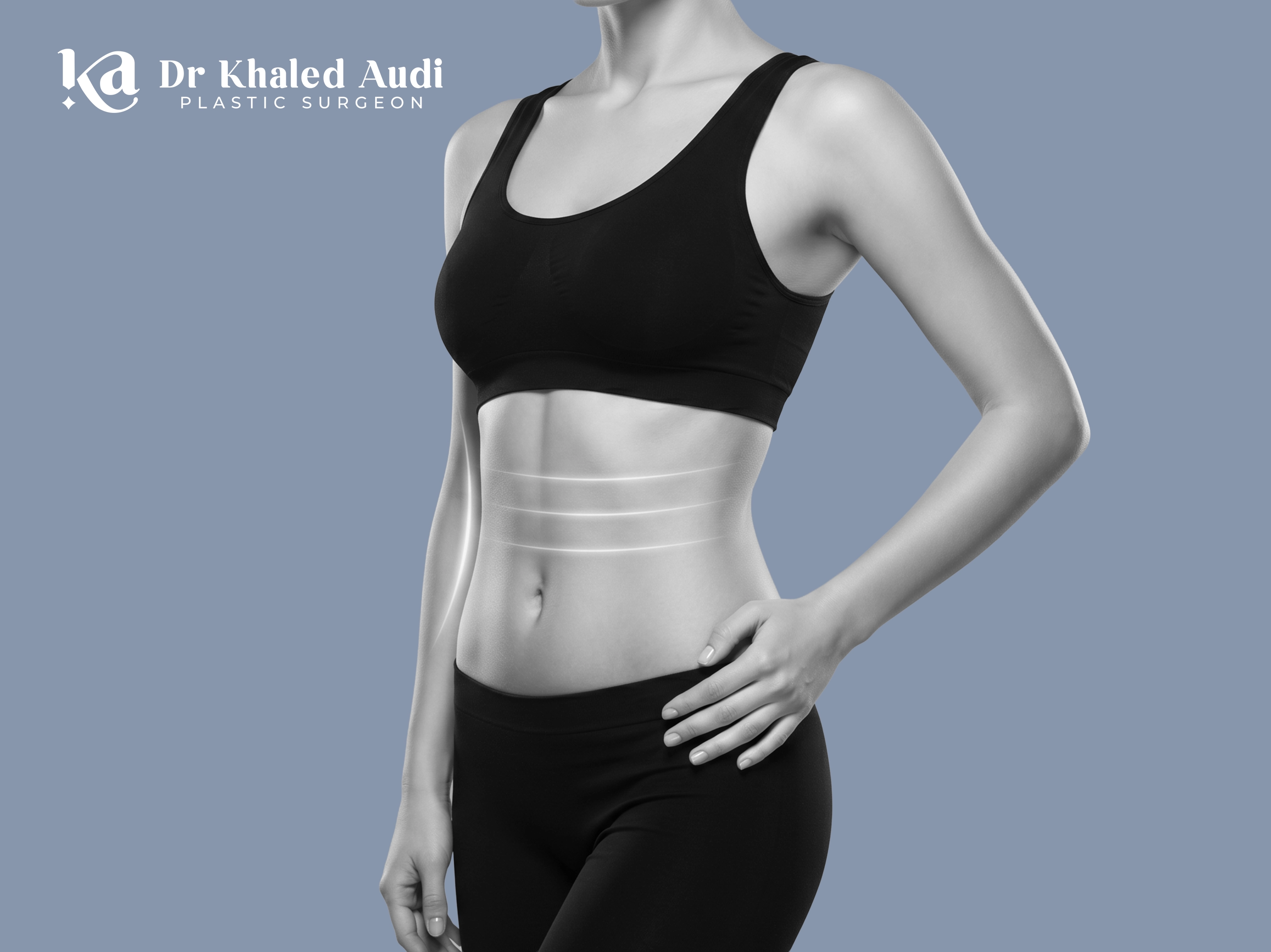 -ش- البطن-Tummy-Tuck